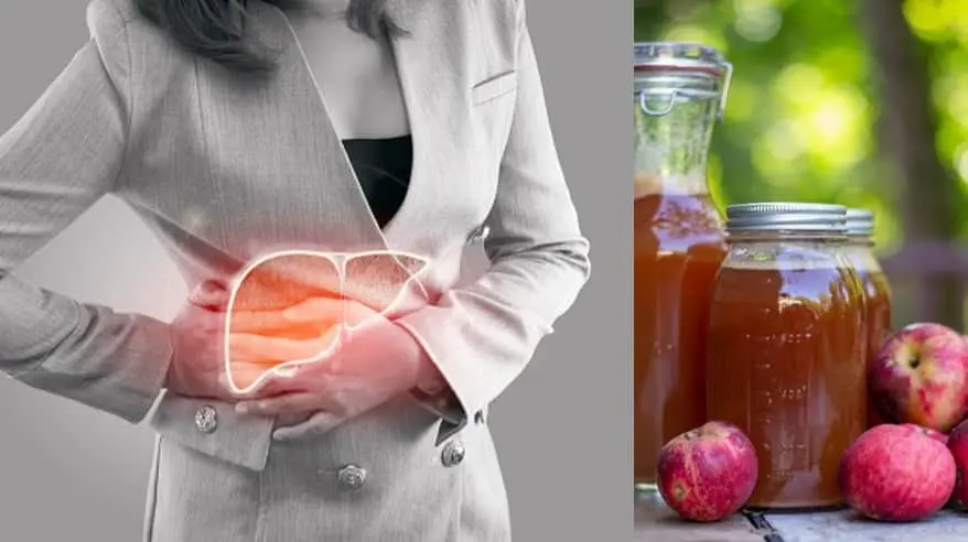 Is Apple Cider Vinegar Good for Fatty Liver
