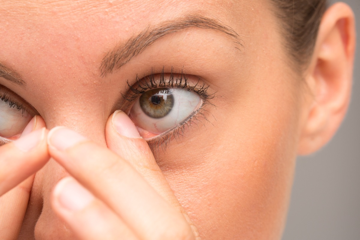 Woman rubbing her eyes.