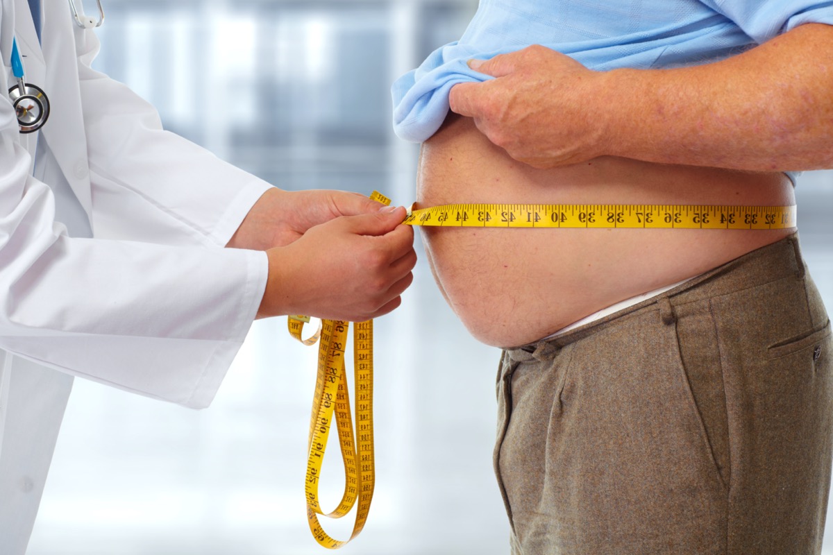 Doctor measuring waist body fat of obese man.  Obesity and weight loss.