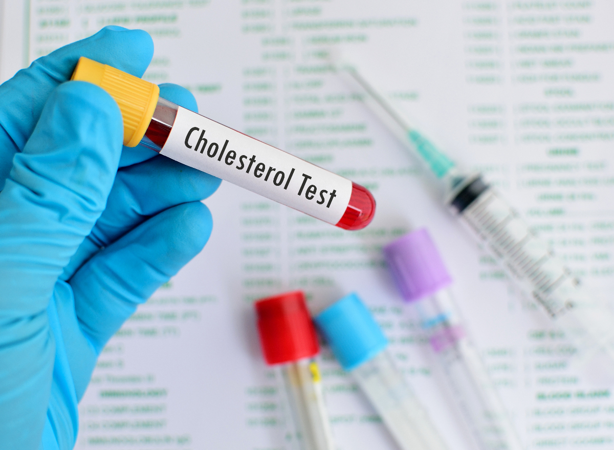 close-up of doctor's hand holding a blood sample for cholesterol