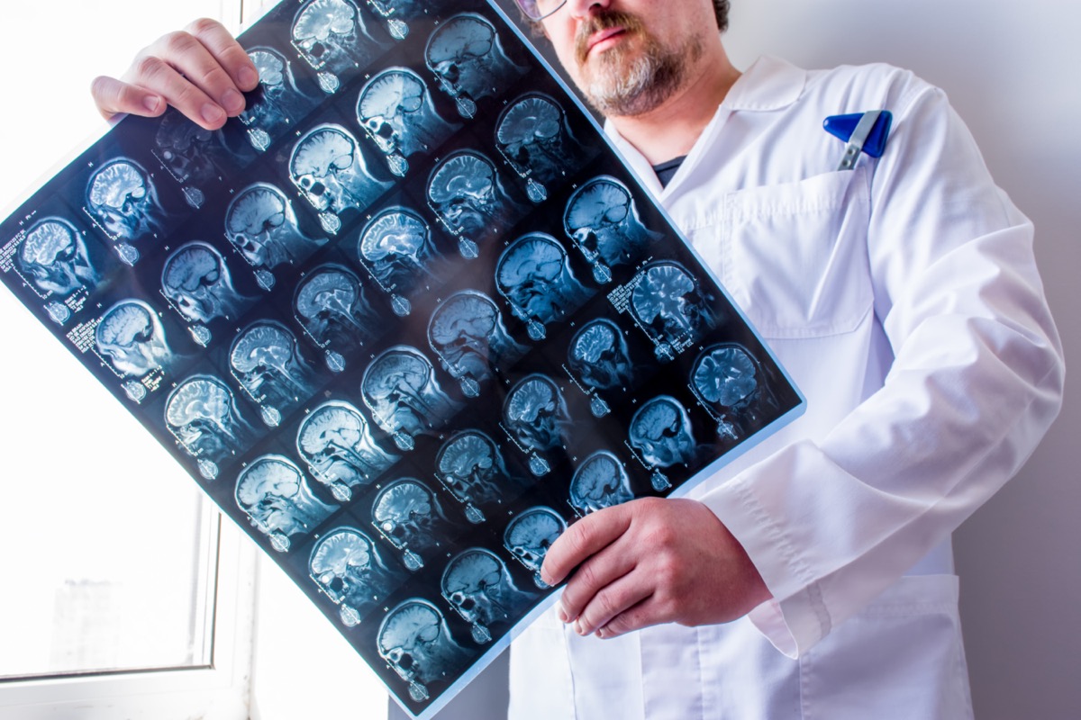 The doctor examines the MRI of the patient's head, neck and brain