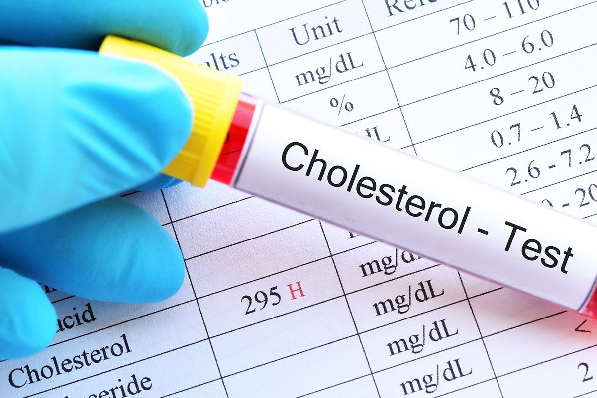 high cholesterol